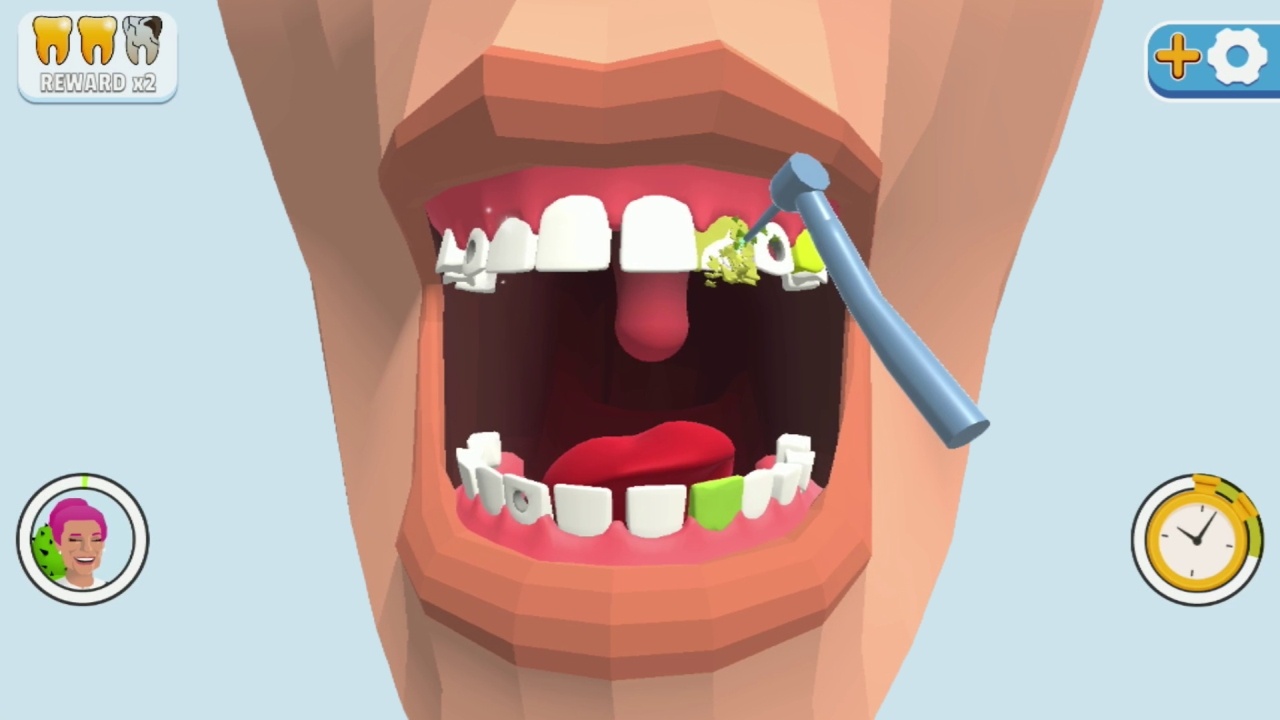 牙齿装饰.Dentist Bling_3