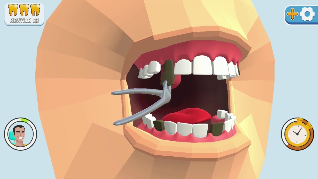 牙齿装饰.Dentist Bling_4